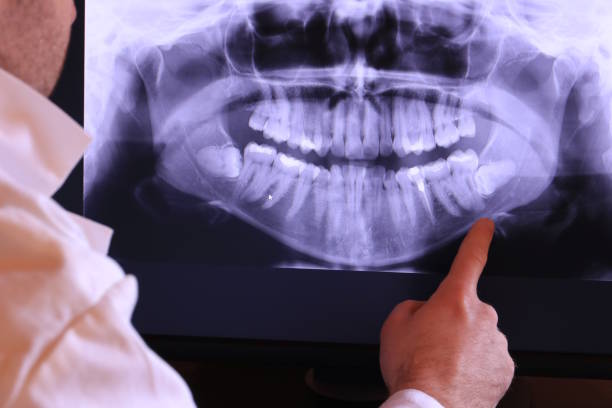 Urgent Tooth Repair in TX